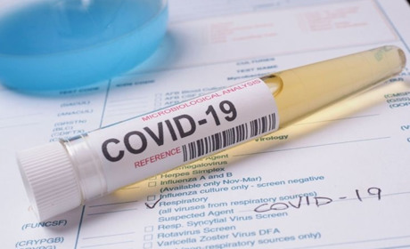 COVID-19: на Хмельниччині та в Україні нові антирекорди