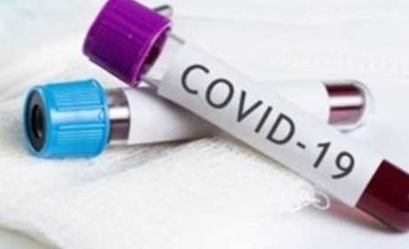 COVID-19: у Нетішині за добу - 7 нових випадків, в області - 131, в Україні - черговий антирекорд