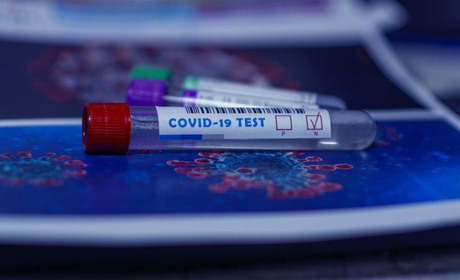 У Чортківському районі зафіксовано 24 нових випадки COVID-19