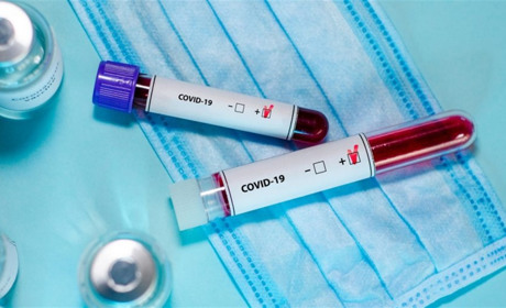 За минулу добу — 13 хворих : динаміка захворюваності на COVID-19