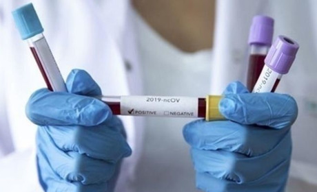 COVID-19 на Чортківщині. Ще шість нових випадків та один летальний