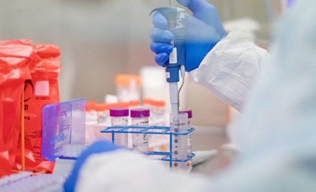 COVID-19: на Старокостянтинівщині додалося 14 хворих