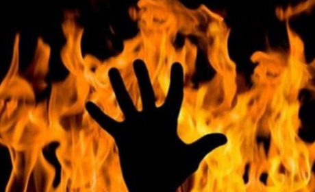 На Золотоніщині через нещасний випадок  загинула пенсіонерка