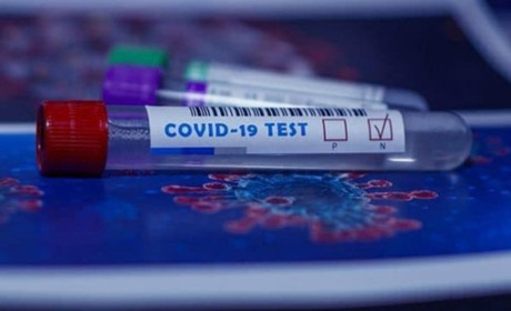 Коронавірус на Гадяччині: дані за 27 жовтня