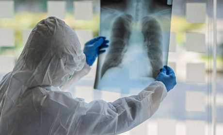 Нічого спільного з грипом: три етапи розвитку коронавірусу