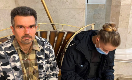 Розбили телефон і побили. У Новій Каховці напали на журналіста. Кримінальне провадження вже відкрили