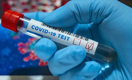 COVID-19 на Чортківщині: 12 нових випадків, одна особа померла
