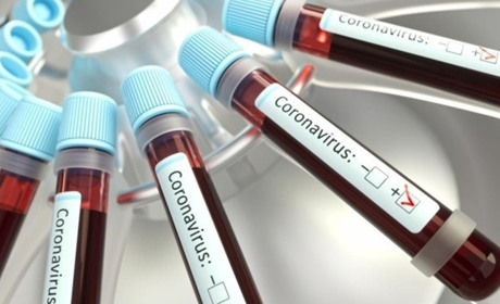 7 – у місті, 22 – в районі: офіційна статистика COVID-19