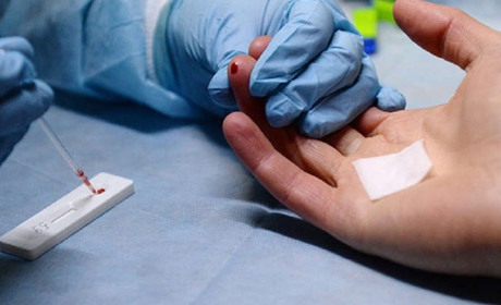 Не коронавірусом єдиним: яка ситуація із захворюванням на ВІЛ-інфекцію на Гадяччині