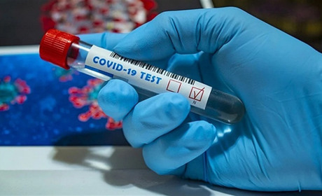 COVID-19: з початку пандемії 997 нетішинців захворіло, 706 - одужало