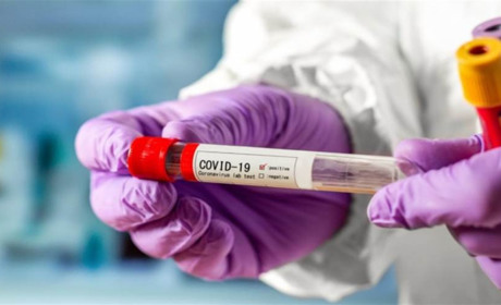 У Чернігівській області виявлено 527 нових випадків COVID-19