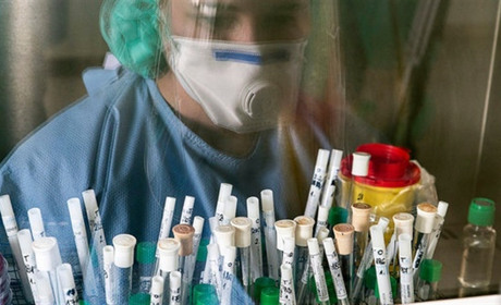 COVID-19: на Старокостянтинівщині додалося чотири десятки хворих 