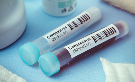 Коронавірус на Гадяччині: дані за 1 грудня