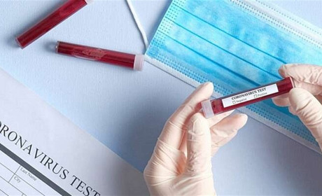 За минулу добу на коронавірус захворіли 36 гадячан