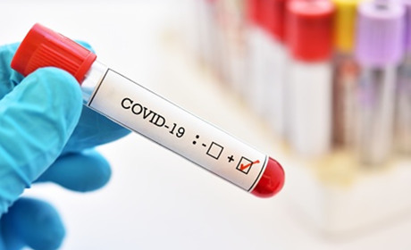COVID-19:  актуальна статистика  на 14 грудня