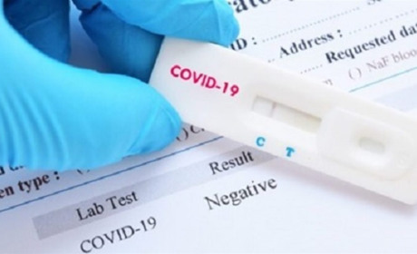 Від початку карантину на Гадяччині діагностували 534 випадків захворювання на COVID-19