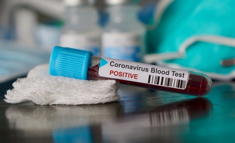 Коронавірус на Сірогозщині: інформація за станом на 10 годину 28 грудня
