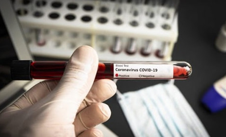 + 1 новий випадок COVID-19 у Чорткові