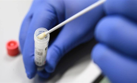 На Луганщині COVID-19 лабораторно підтвердився за час карантину у 12604 людей