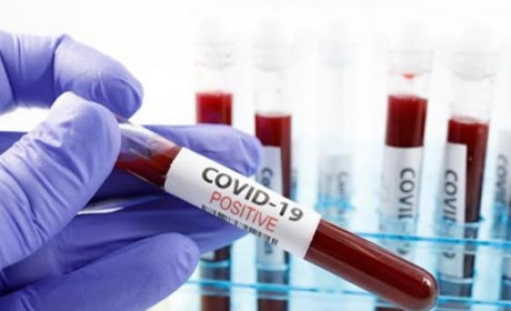 COVID-19 на Гадяччині: дані за 18 січня