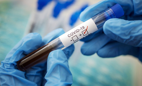 У Южному зареєстровано 1829 випадків коронавірусу