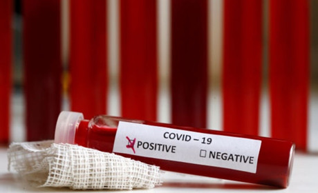 Коронавірус на Гадяччині: дані за 23 січня