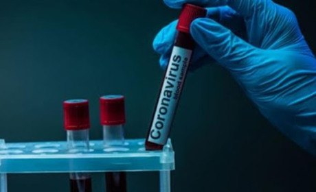 На Чортківщині виявили 5 нових випадків COVID-19