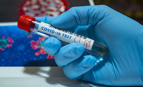 За останню добу в Южному ще 5 осіб захворіло на Covid-19