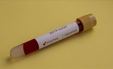 Коронавірус на Гадяччині: дані за 29 січня