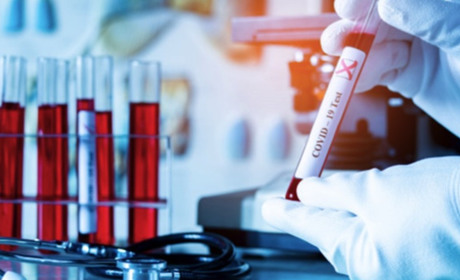 COVID-19 на Гадяччині: дані на 30 січня