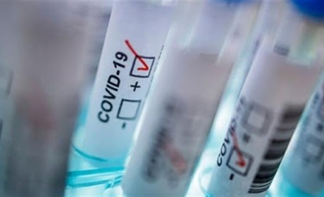 COVID-19 на Гадяччині: дані на 31 січня