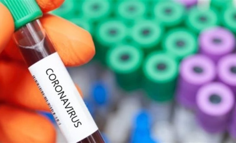 COVID-19 на Чортківщині: одна смерть та 8 нових випадків за добу