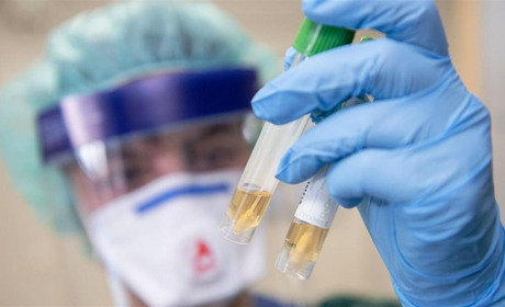 Невтішна статистика: від коронавірусу в Южному померла людина (ІНФОГРАФІКА)