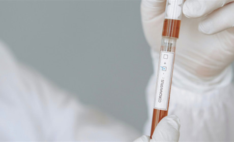 Коронавірусна статистика: хвороба забрала життя трьох старокостянтинівців