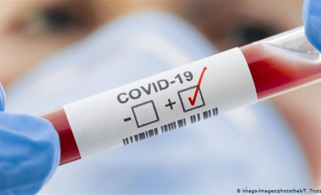 Коронавірус на Чортківщині: 8 нових випадків