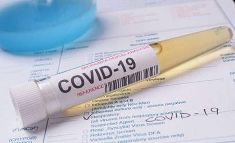 В Южному хворіє 23 особи на COVID-19