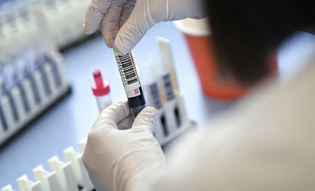 Коронавірус на Гадяччині: яка ситуація сьогодні