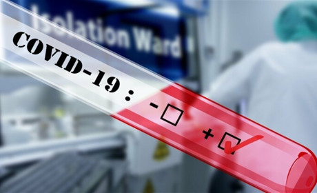 За добу в Луганській області виявили 34 хворих на COVID-19