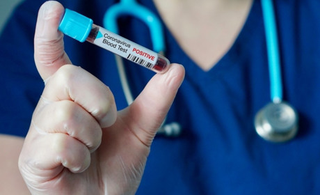 COVID-19 на Гадяччині: дані на 19 лютого