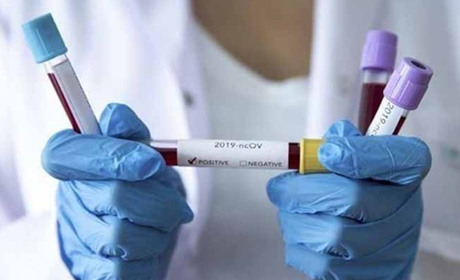 На Чортківщині другу добу поспіль виявляють понад 23 нових випадків COVID-19