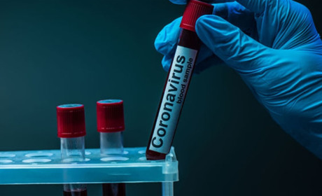 Восьмеро южненців захворіли на СOVID-19 за останню добу 