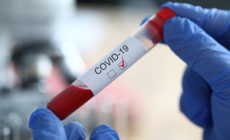 COVID-19 на Чортківщині: лабораторно підтверджено 34 нових випадки