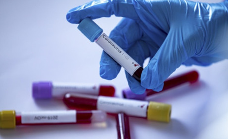 Коронавірус на Гадяччині: дані на 26 лютого