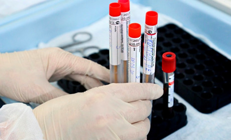 COVID-19 на Гадяччині: ситуація станом на 27 лютого