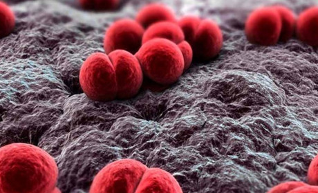 Чи варто хвилюватися через Менінгокову инфекцію