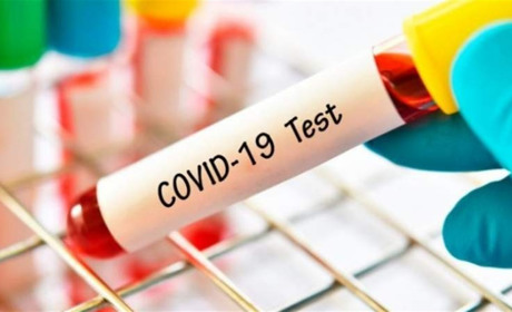 COVID-19 на Гадяччині: ситуація станом на 28 лютого