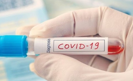 Коронавірус на Гадяччині сьогодні: статистика на 6 березня