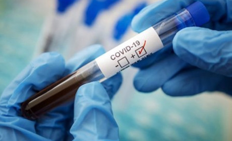 За добу в Луганській області виявили 18 хворих на COVID-19