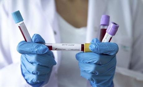 В Южному виявили 27 нових випадків COVID-19 за добу