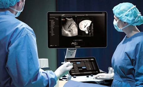 Функціонал УЗД-апаратів розширюється